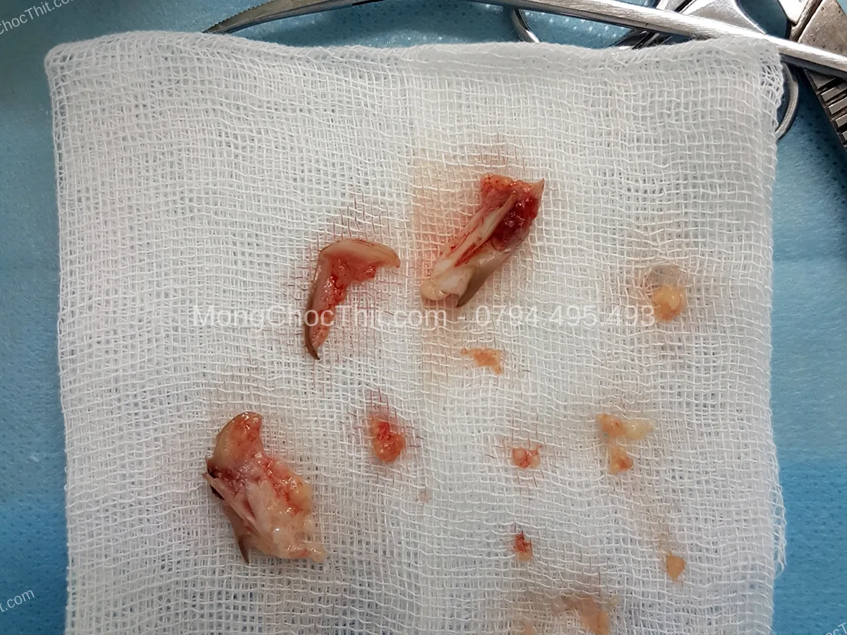 thuốc giảm đau sau tiểu phẫu